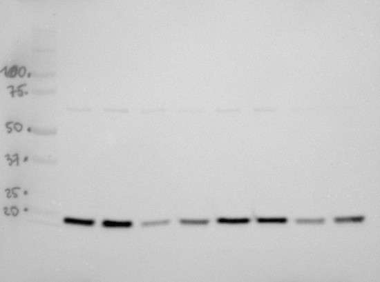 Western blot using anti-LEA4-5 antibodies